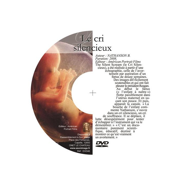 Le cri silencieux - DVD